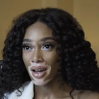 Portrait of Winnie Harlow